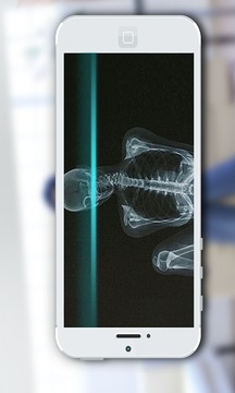 手机x光扫描仪截图1