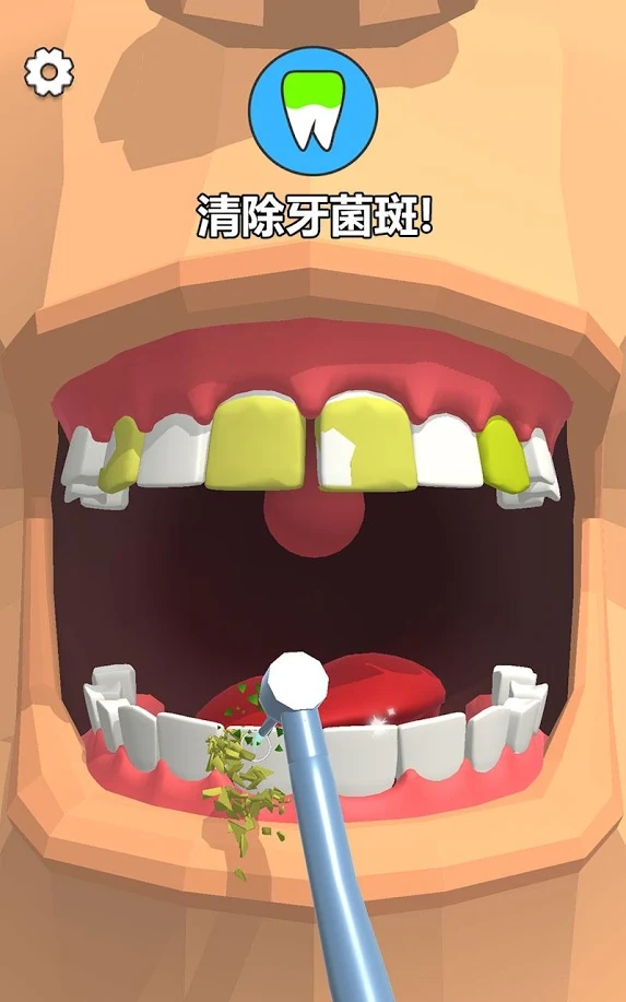 洗牙截图2